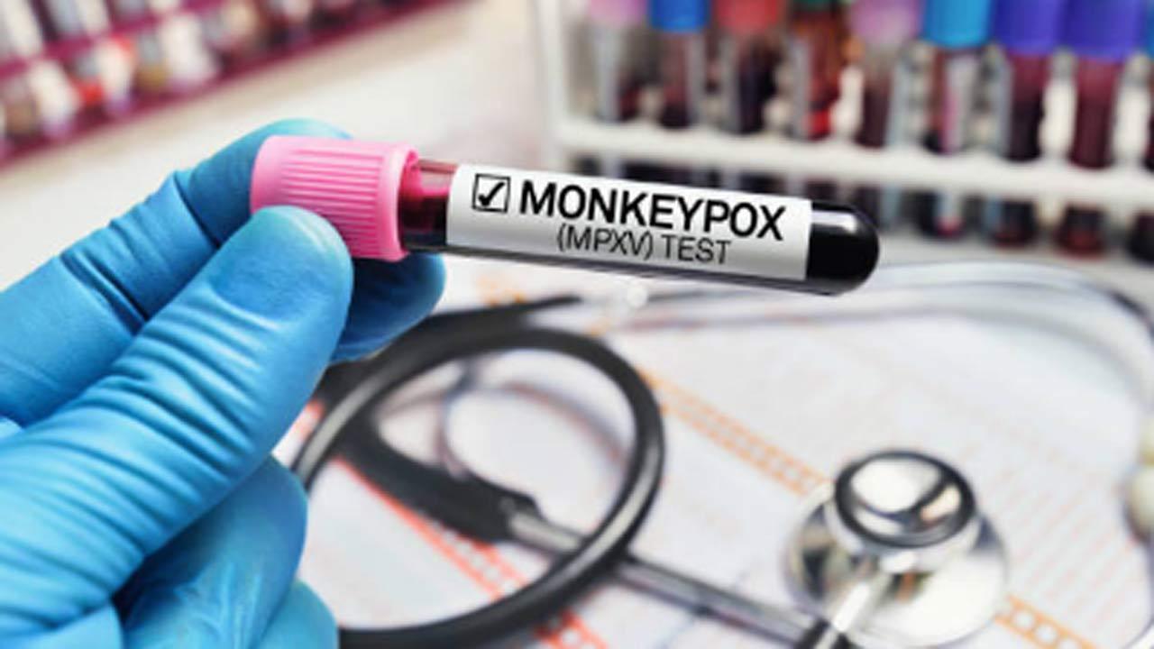 Mpox: Mumbai doctors highlight why the viral disease is deadly