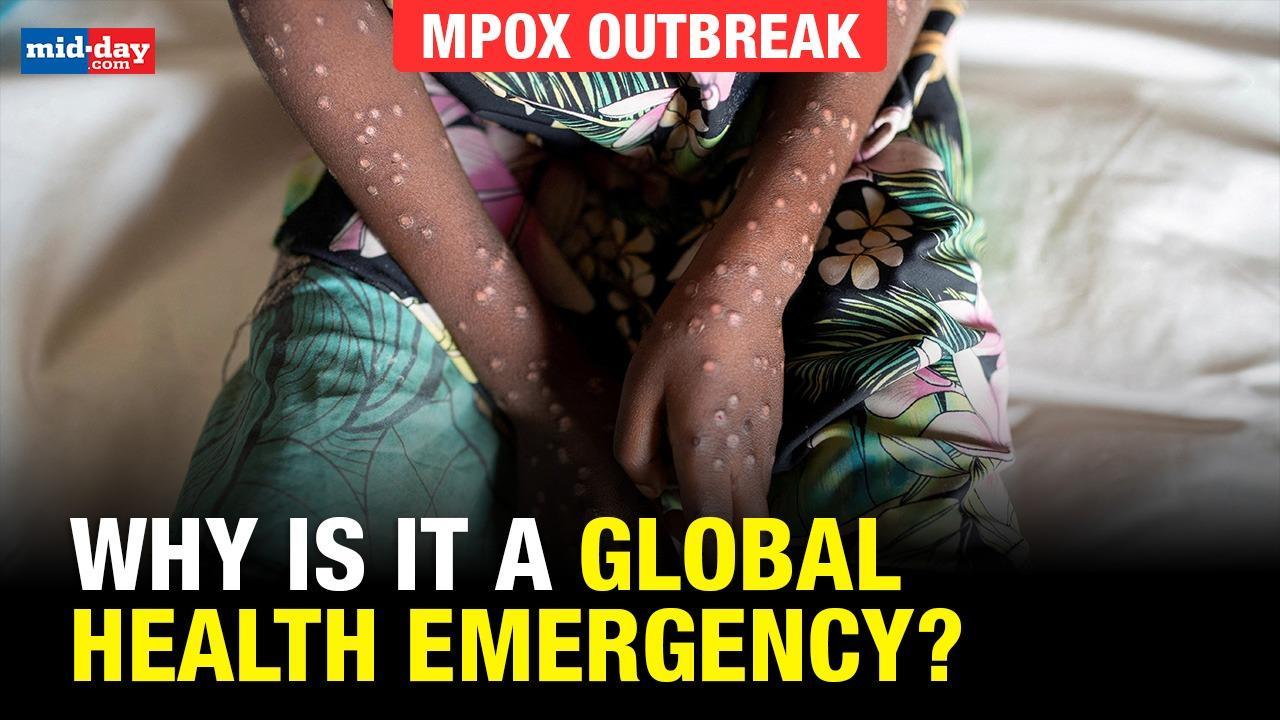 Mpox virus: Causes, symptoms and prevention - EXPLAINED