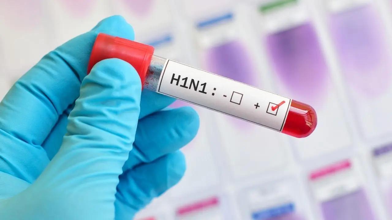 Man dies of swine flu in Beed district