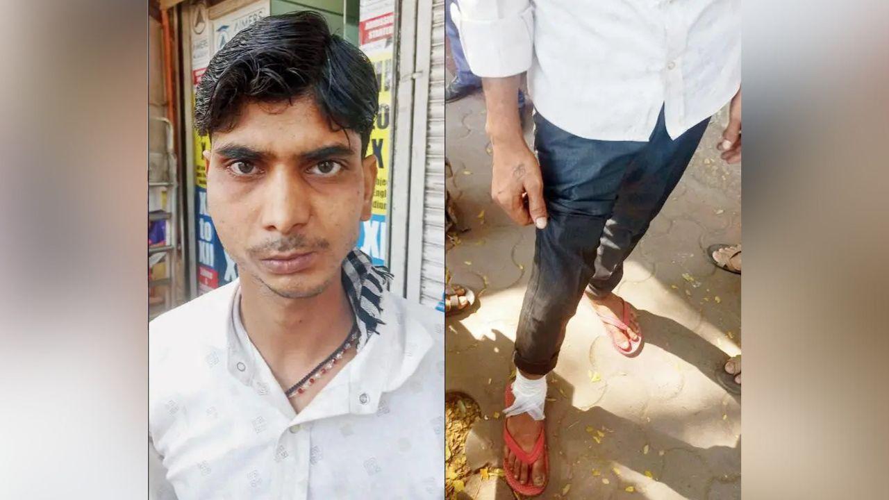 Sukharam Paswan, survivor of the accident (right) Injured leg of Sukharam
Sukharam Paswan, a sweet potato vendor, narrowly escaped the bus. Originally from Uttar Pradesh, Paswan is a resident of Shankar Mandir in Kurla, where he sells baked sweet potatoes to earn a living. Describing his near-death experience, Paswan said, “If I had been two seconds late in getting out of the way, I wouldn’t have been alive today. The bus hit my sweet potato stall. I consider myself very lucky to be alive. I have minor injuries and 2-3 stitches on my leg.”