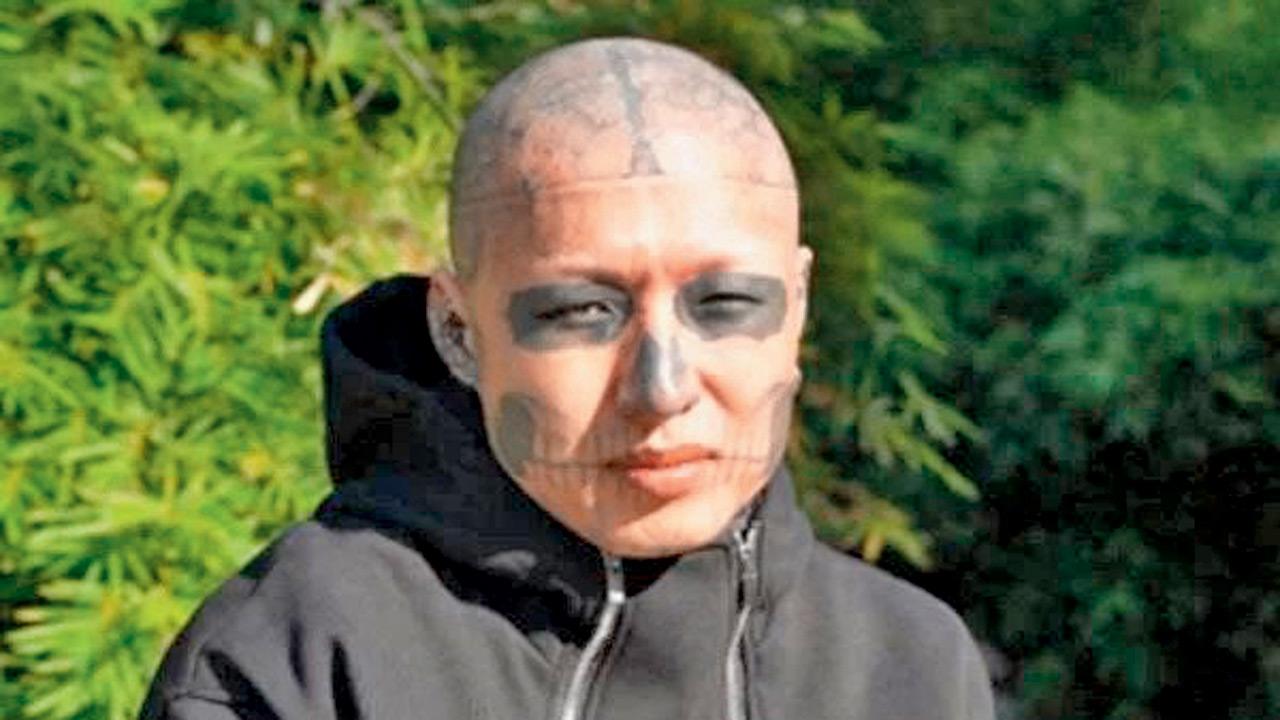Mr A is currently undergoing tattoo removal. PICs/ODDITY CENTRAL