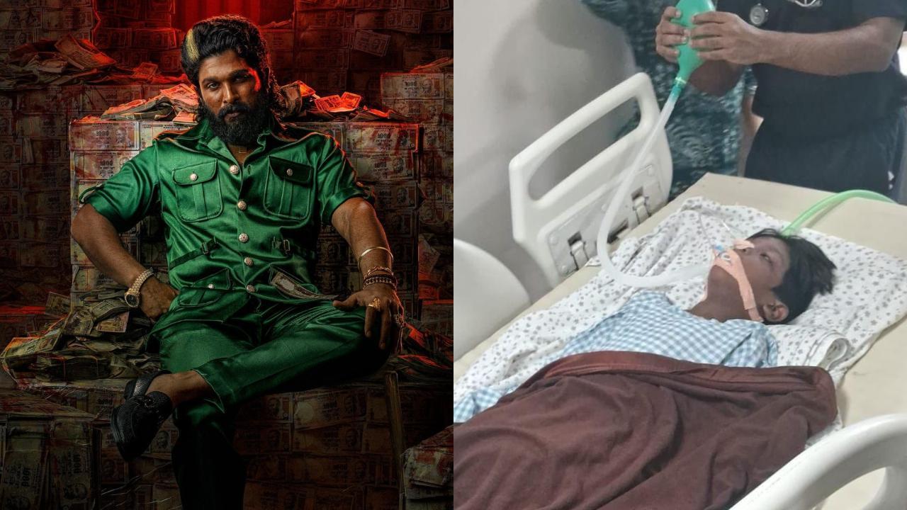 8-year-old boy injured in Pushpa 2 stampede is now on ventilator with tube feedings