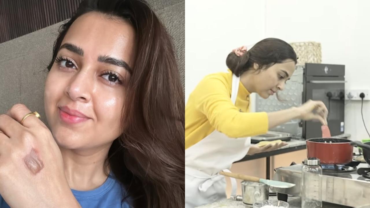 Tejasswi Prakash shows courage writes 'show must go on' despite burning herself