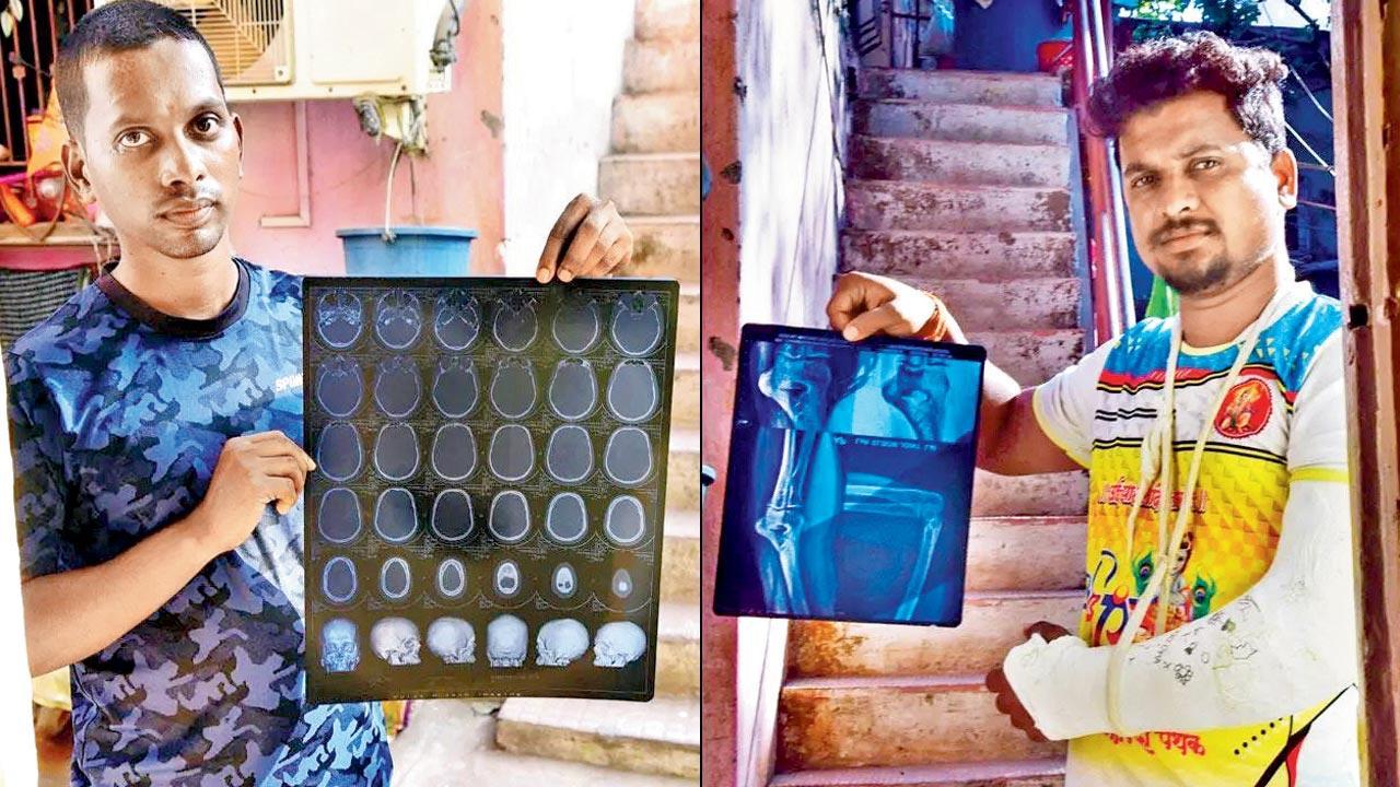 Mumbai: Victims demand transparency in Bangur Nagar assault case