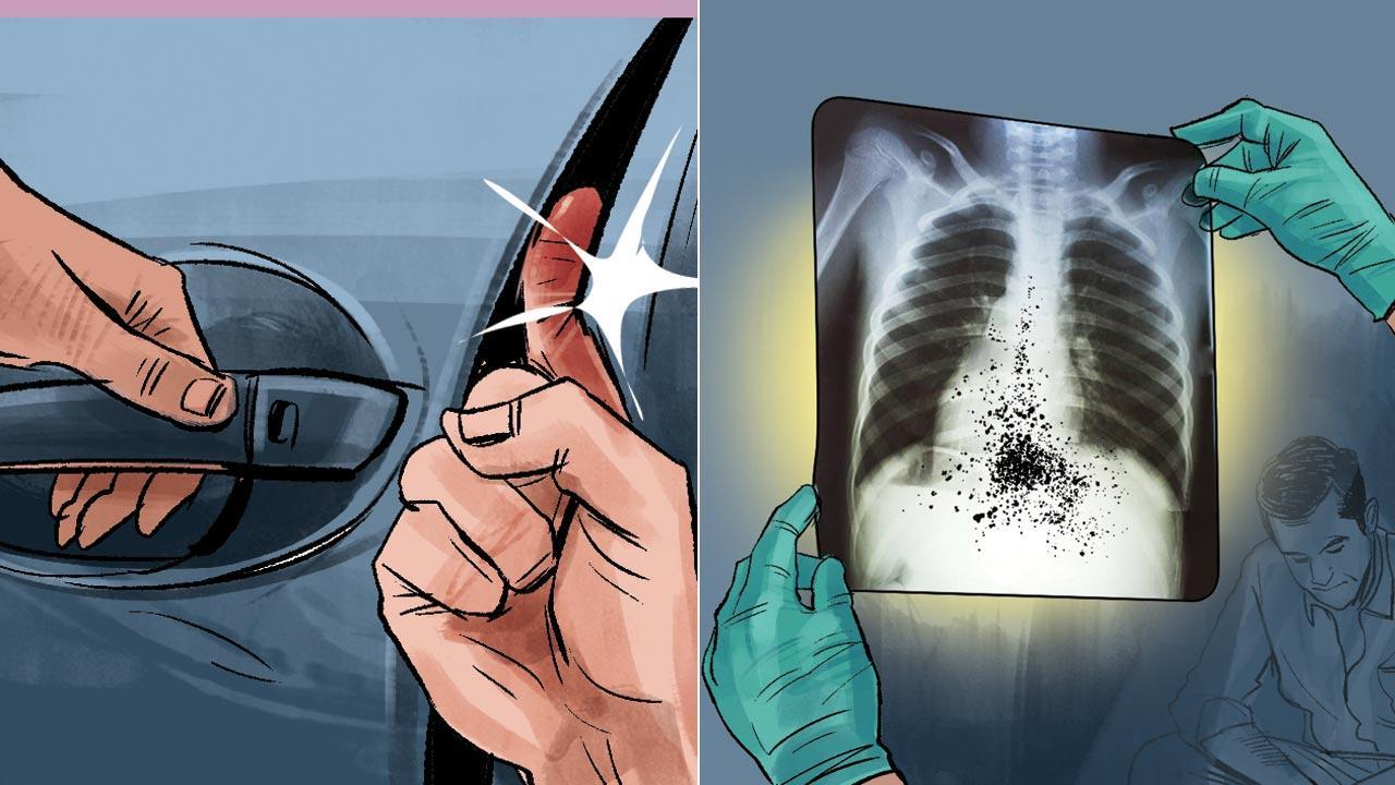 Mumbai: How to make and fake injuries to fix enemies