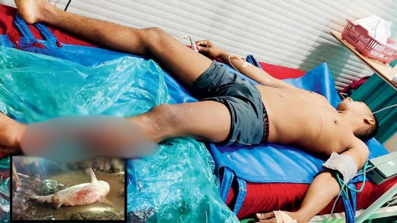 Jaws in Palghar: Bull shark rips fisherman's leg