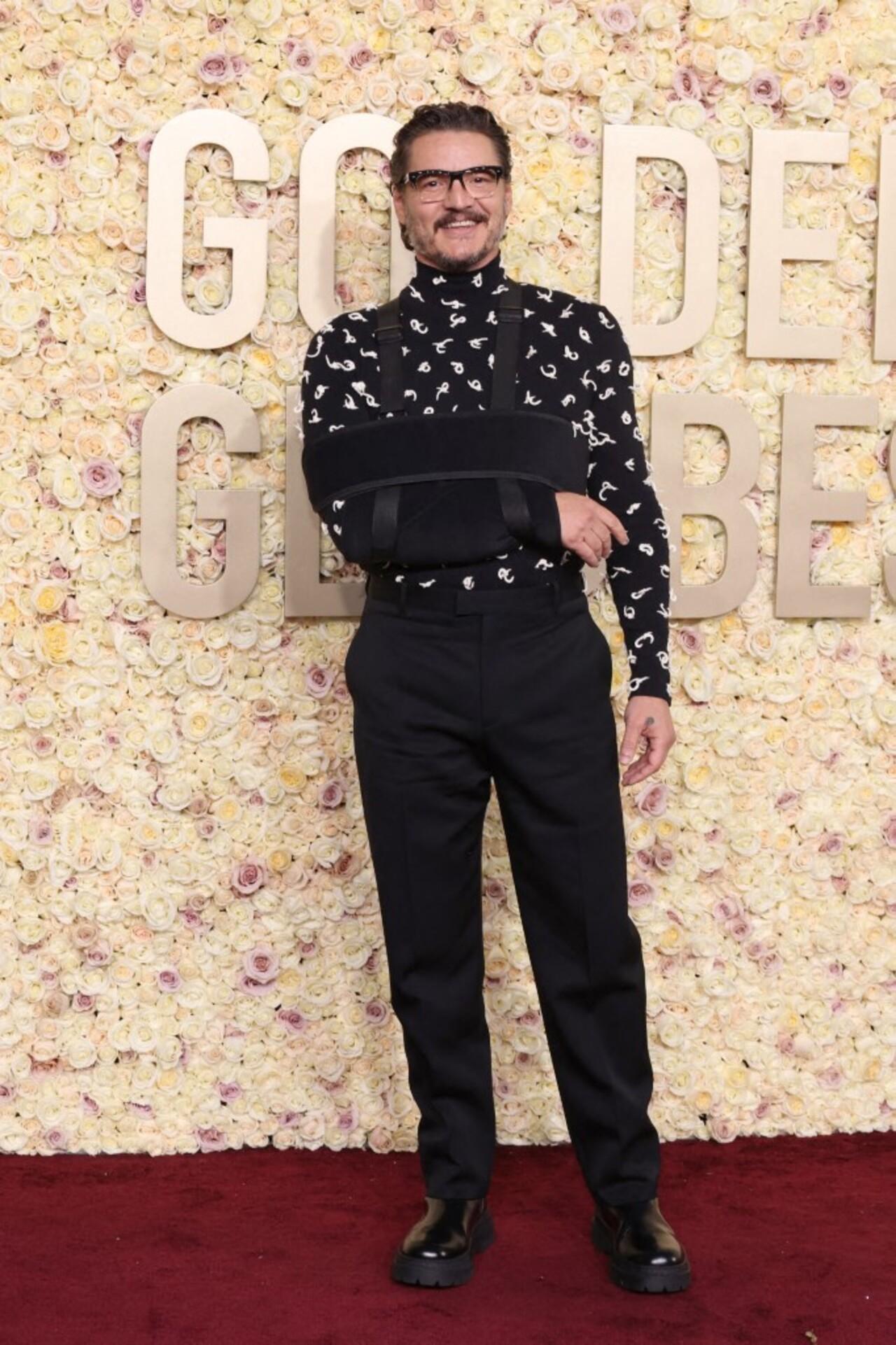 Pedro Pascal was all smiles despite an injury. The actor who was nominated for the globes was dressed in a black-and-white printed sweater