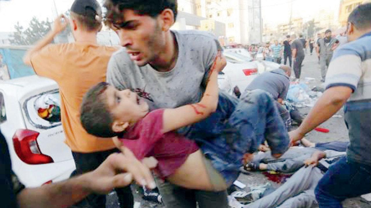 A Palestinian man rushes an injured child for medical aid as others lay injured in the street