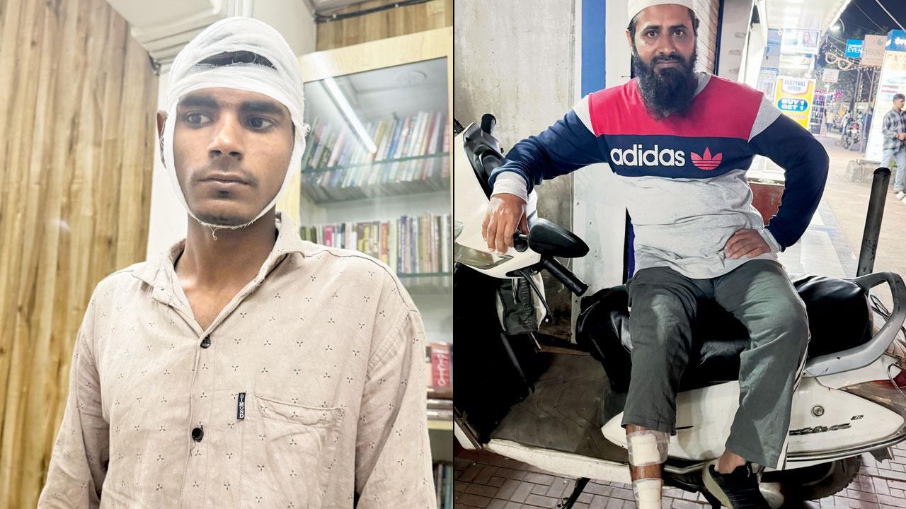 Matiullah who works at a scrap shop received stitches to his head (right) Mohamad Umar, whose leg was injured