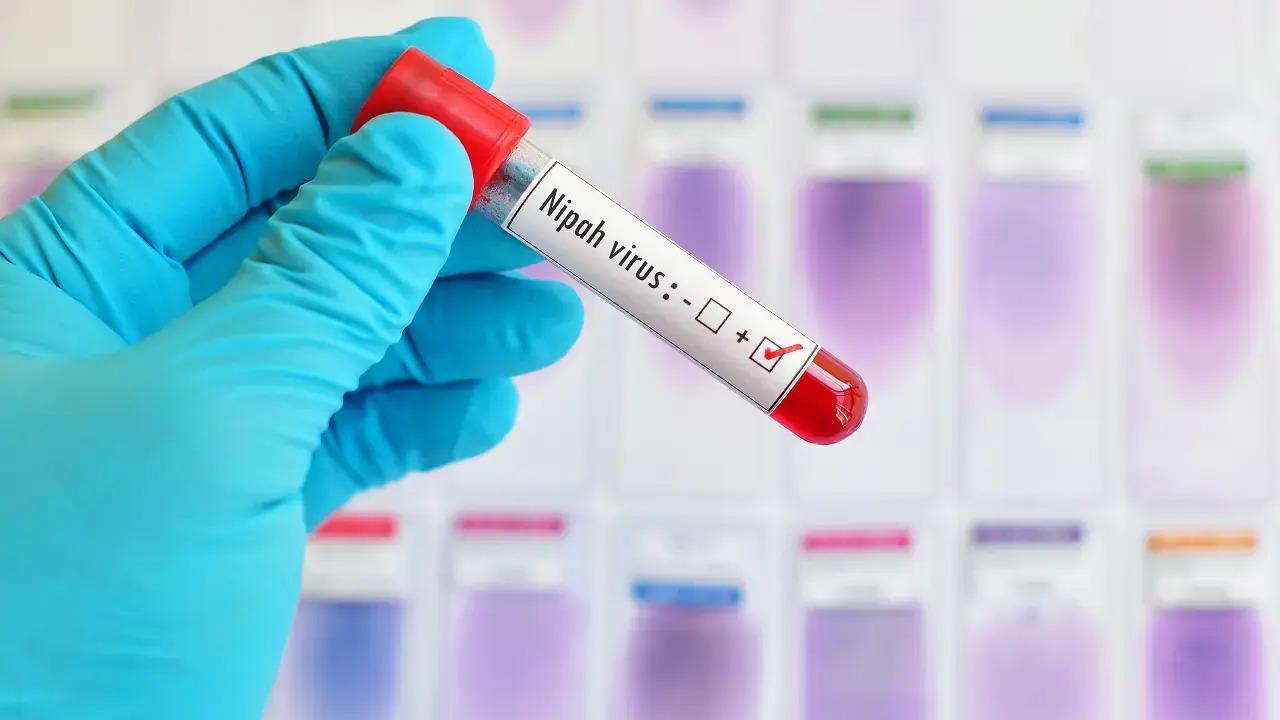 Rajasthan issues Nipah Virus alert after 14-year-old succumbs to virus in Kerala