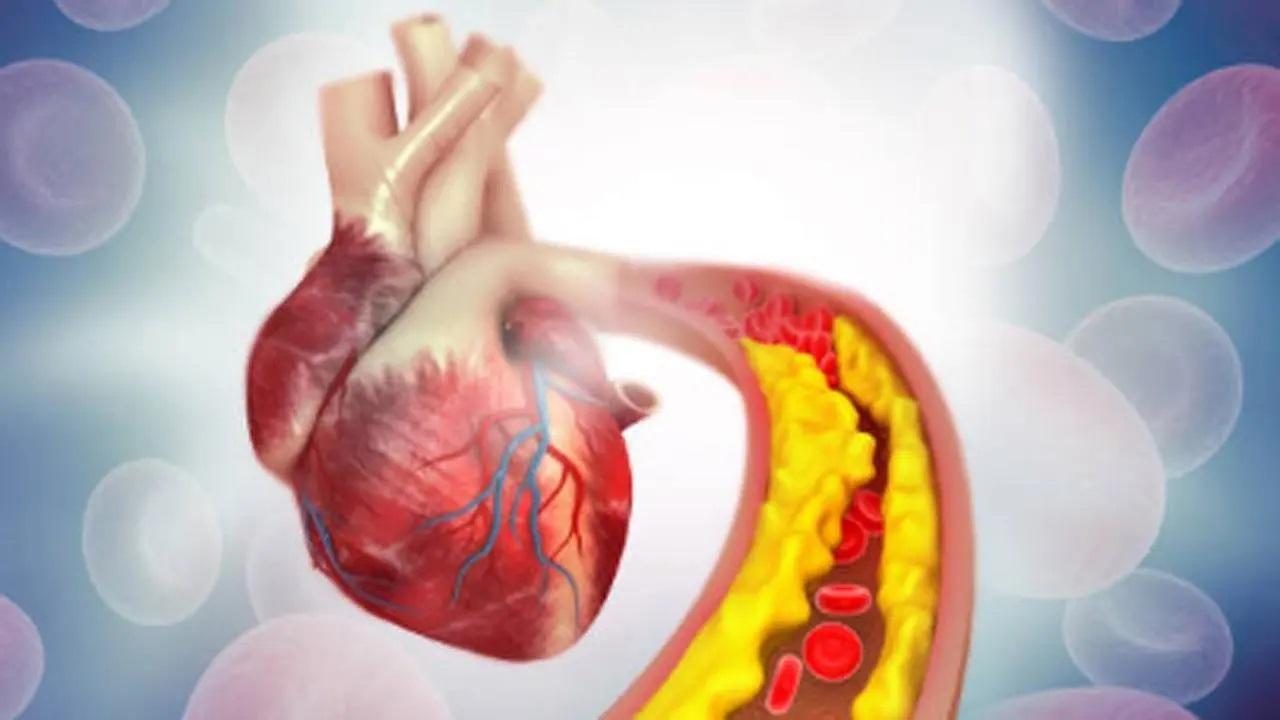Why high cholesterol is a silent killer, major risk for heart disease in India