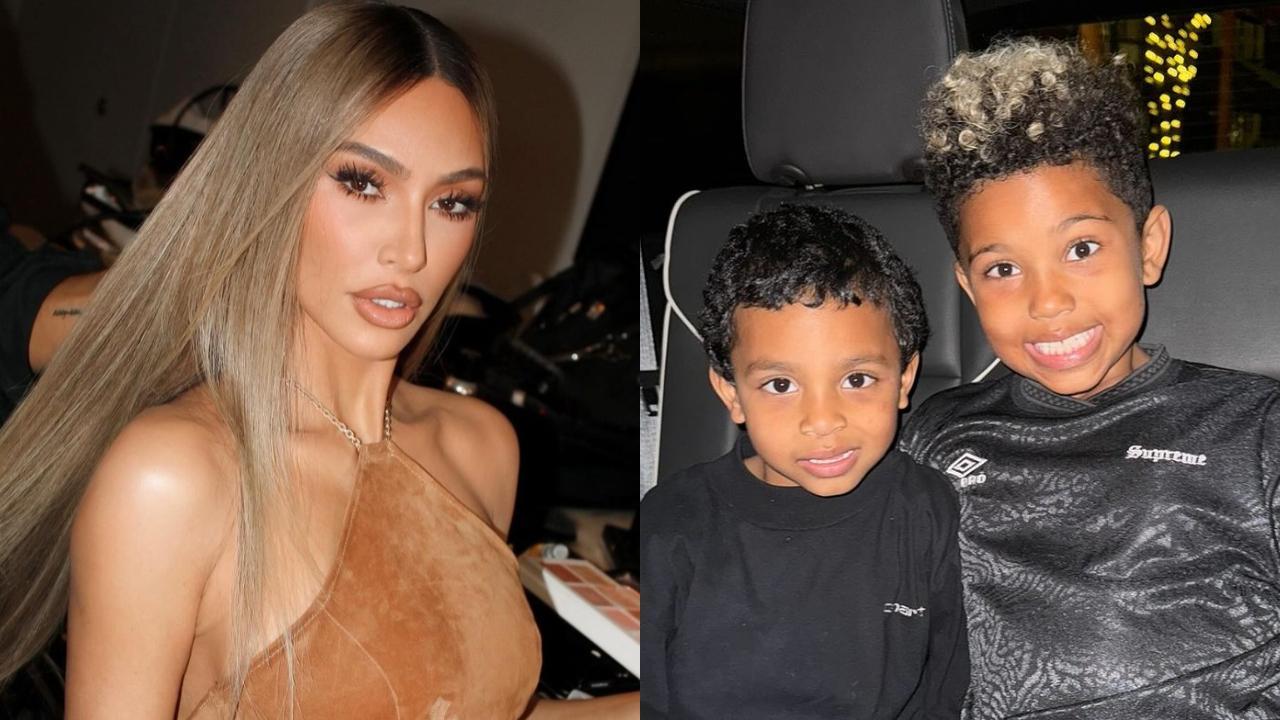 Kim Kardashian, Kanye West's son has rare skin condition