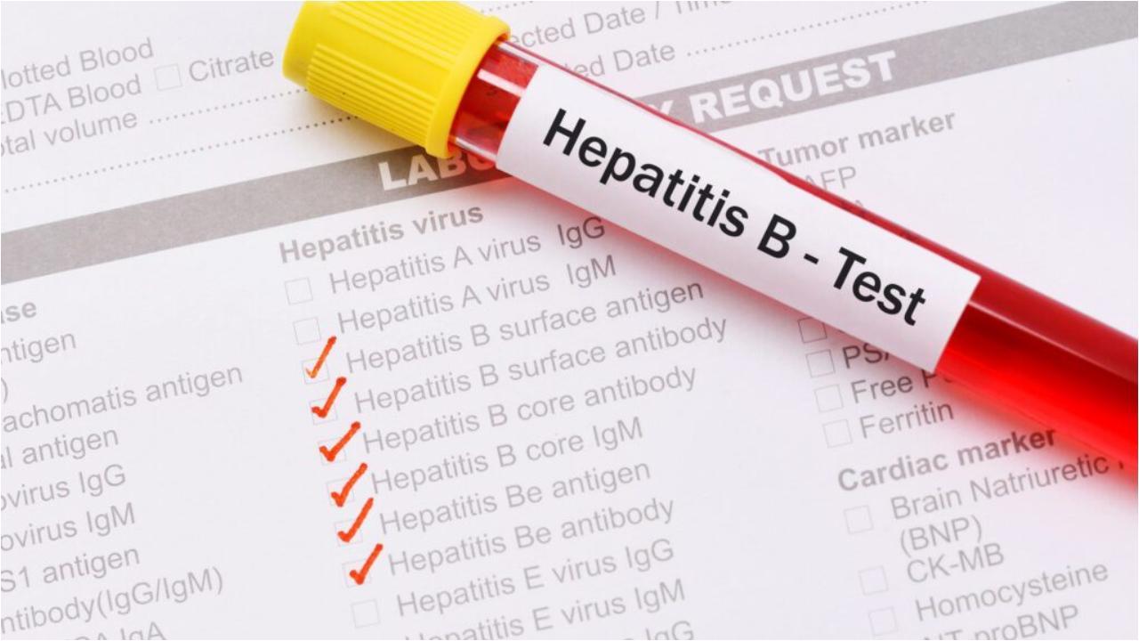 Liver-related problems are on the rise in youngsters aged 23-35