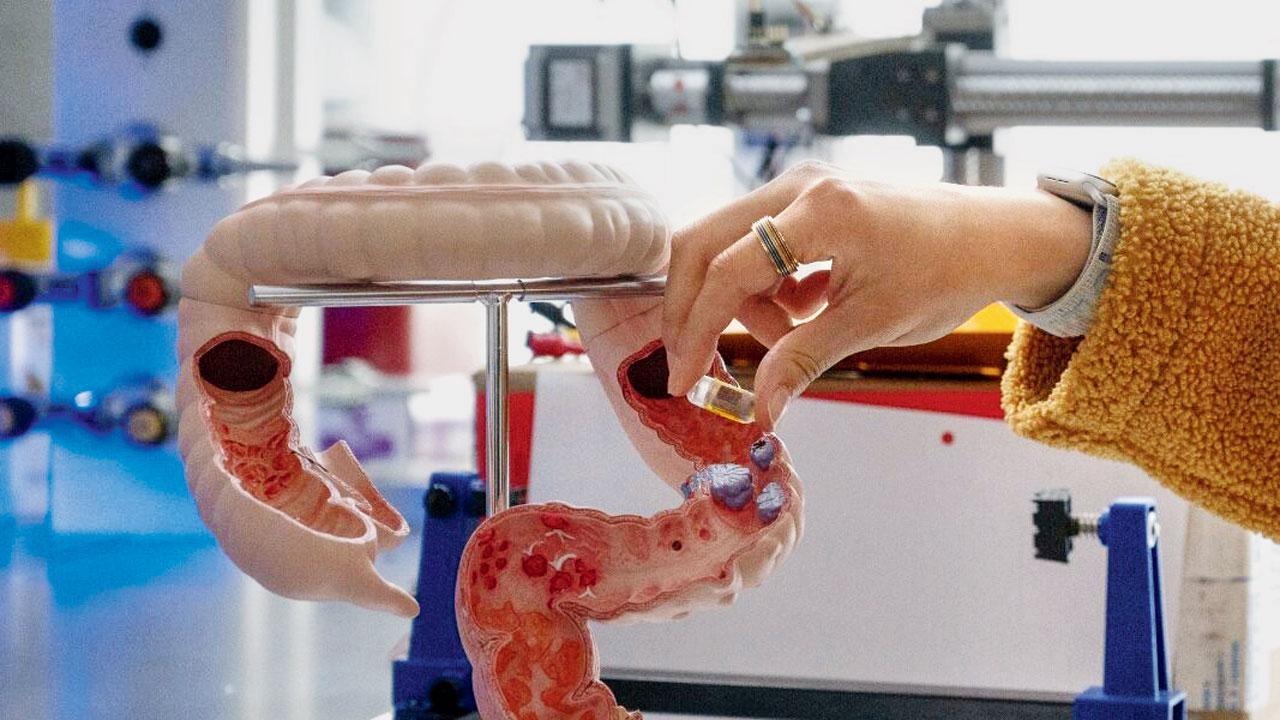 AI-powered smart pills offer early detection of gastric diseases