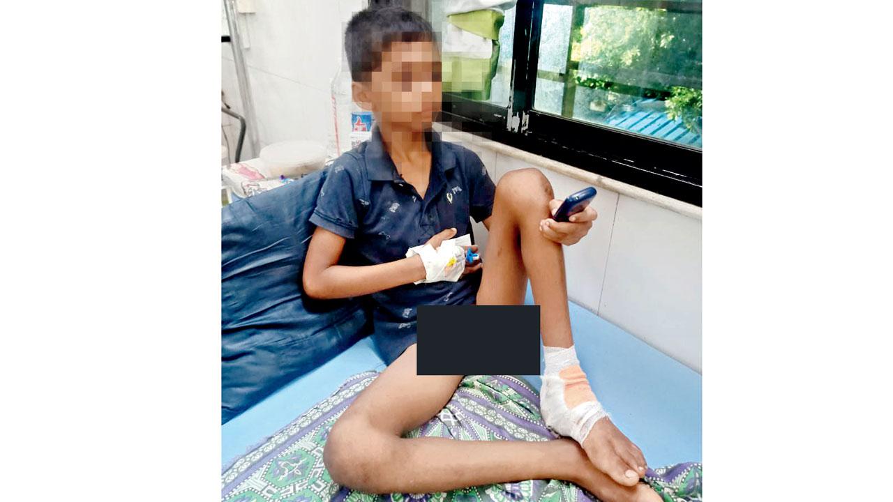 The boy had been admitted after suffering an injury to his left leg. Pic/Navneet Barhate