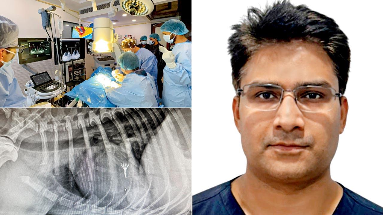 Dr Bhanu Dev Sharma performs a first-of-its-kind, minimally invasive cardiac surgery on a dog in Delhi;  the procedure involves implanting  a valve clamp inside the heart through a 5-cm incision in the chest