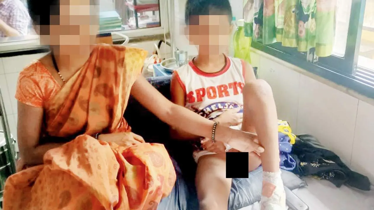 Thane: Boy goes for surgery, gets a circumcision!