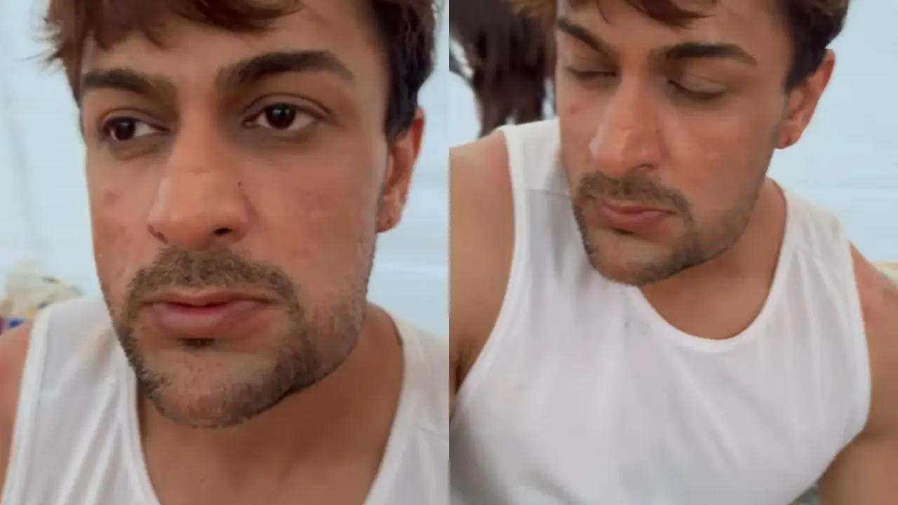 Khatron Ke Khiladi 14: Shalin Bhanot has taken to his Instagram and shared that he has picked up an injury. Read More
