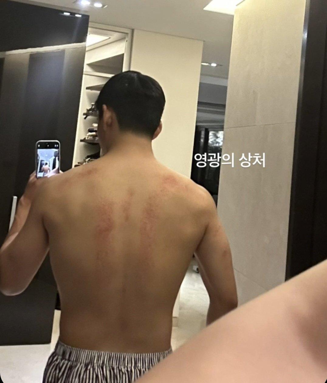 BTS member V, also known as Kim Taehyung, thrilled fans with photos showing off his impressive physique, developed through intense training as an elite Special Forces soldier in the Military Police division.