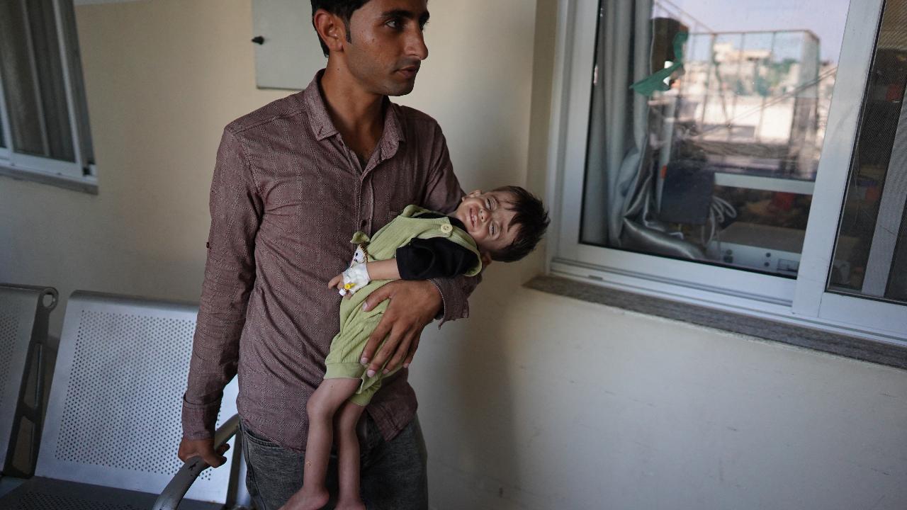 According to the United Nations Relief and Works Agency (UNRWA), over 50,000 children in the Gaza Strip require immediate medical treatment for acute malnutrition. Amid the ongoing conflict, access to essential healthcare remains a critical challenge