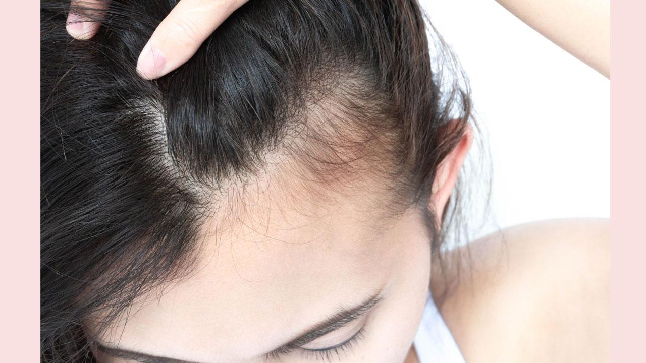 How To Stop Hair Thinning