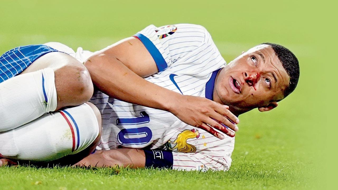 ‘Mbappe’s nose is a mess’