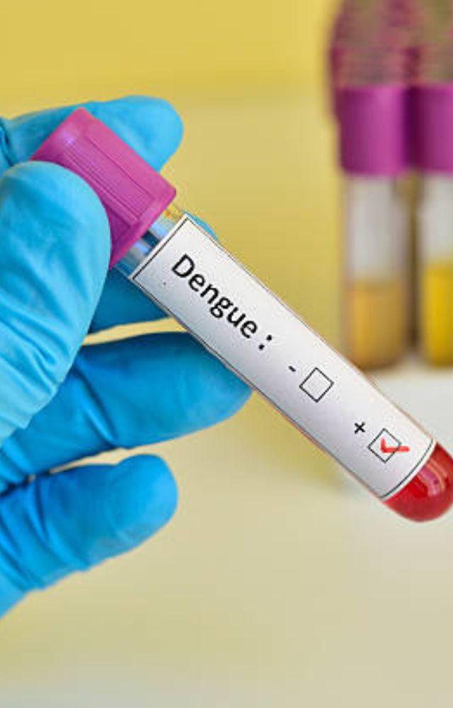 Dengue fever is caused by the dengue virus, transmitted by Aedes mosquitoes. These mosquitoes breed in stagnant water, which is abundant during monsoon 
