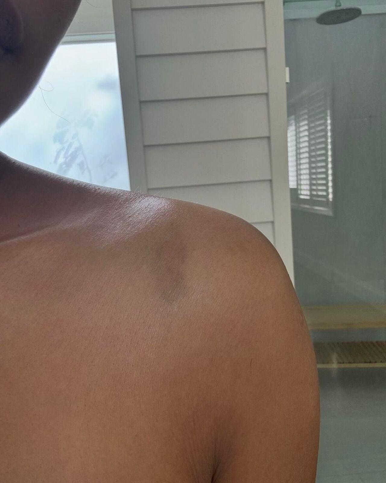 Priyanka also showed her fans some injuries she got on her body during The Bluff shoot