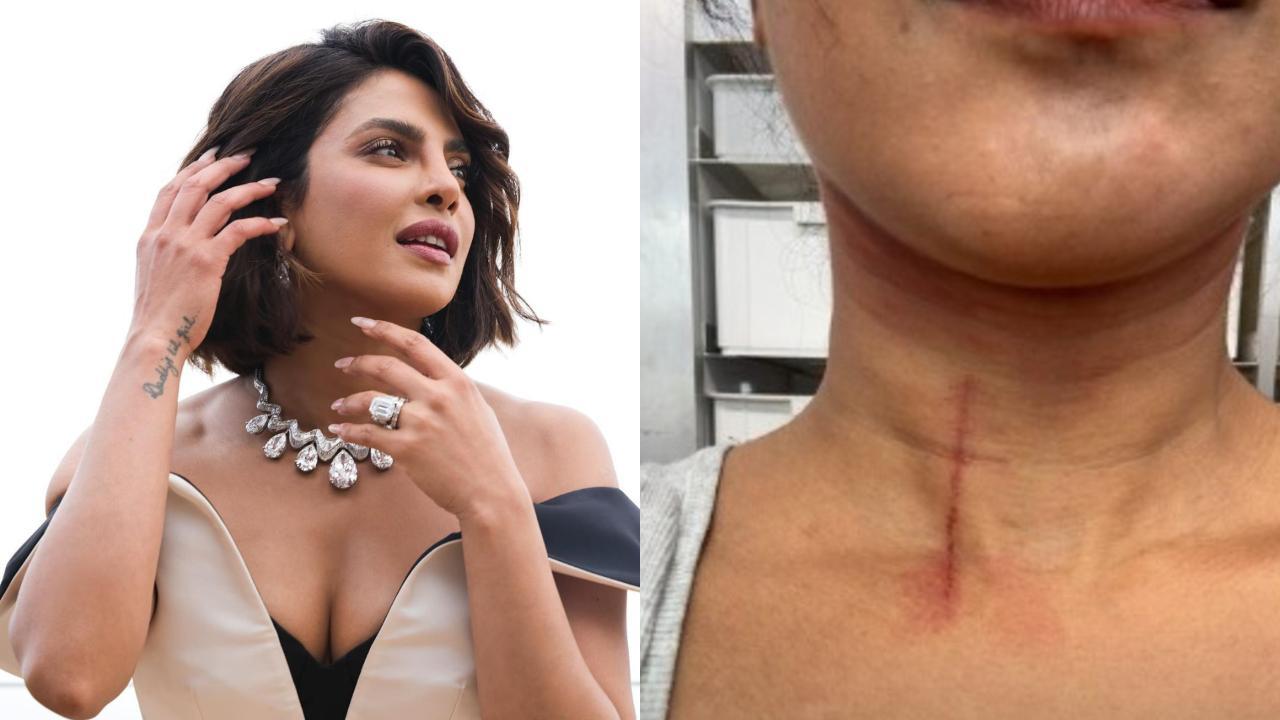 Priyanka Chopra Jonas injured on the sets of 'The Bluff'