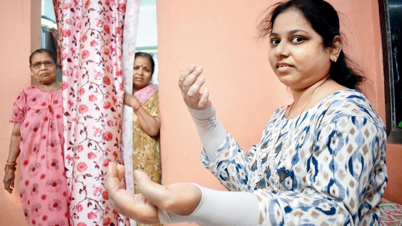 Monika More, the city’s first-hand transplant recipient, at her Kurla residence. Pic/Sameer Markande