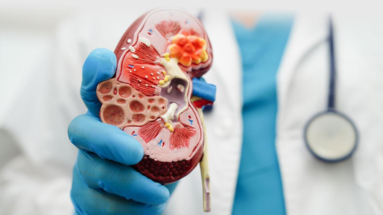 Can homeopathy be effective in treating chronic kidney disorder?
