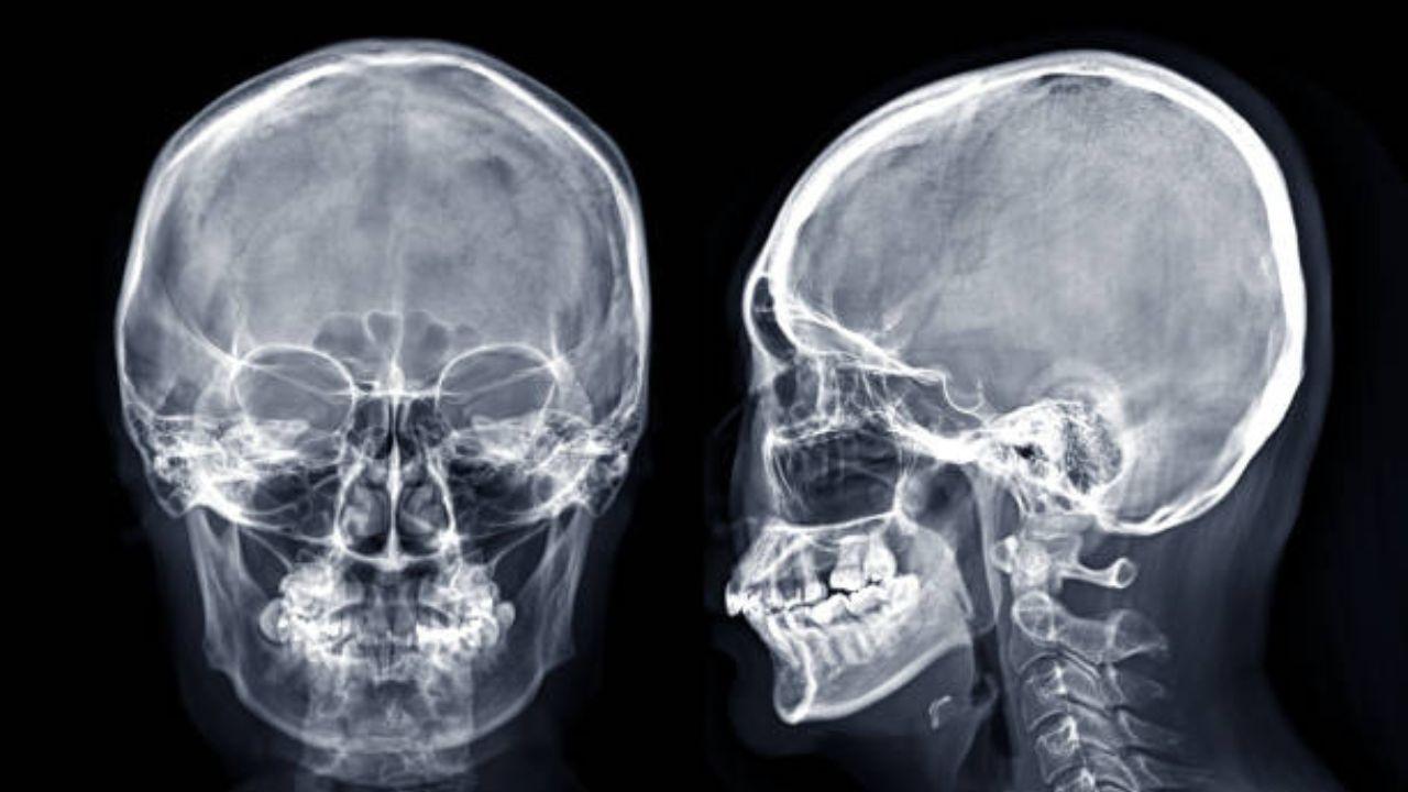 The study shows cut marks on the skulls which reveal the extent of traumatological and oncological treatments practised by the ancient Egyptians.