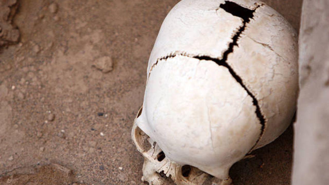 A study on two 4,000-year-old skulls revealed that Ancient Egyptians attempted to operate on excessive tissue growth or learn more about cancerous disorders after a patient's death