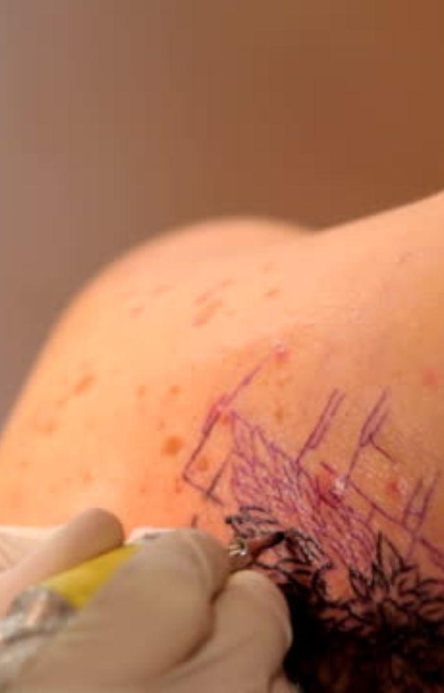 Tattoos pose risk of cancers? 