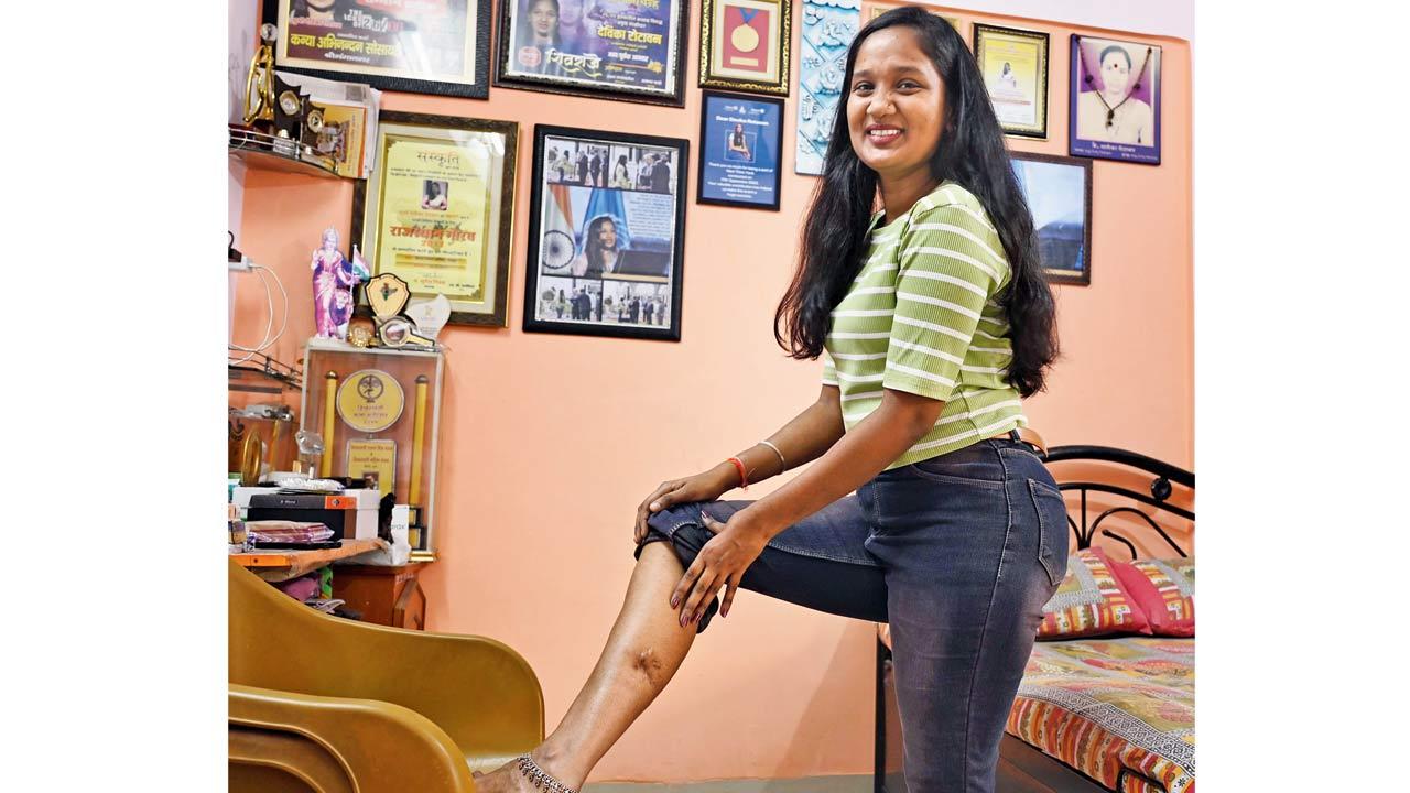 Devika Rotawan, a survivor of the November 26 attack on CSMT station, at her Bandra residence. Pics/Ashish Raje 