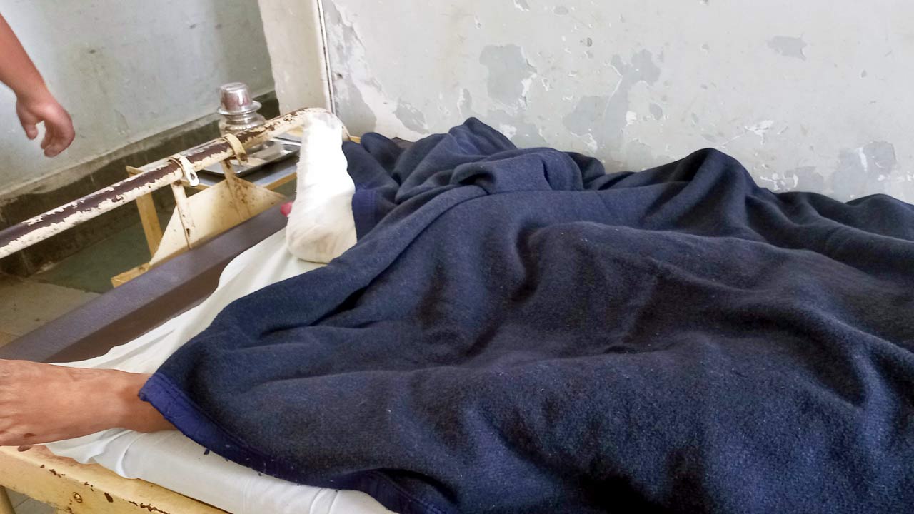Ramsevak Prajapati’s right leg was injured during the stampede