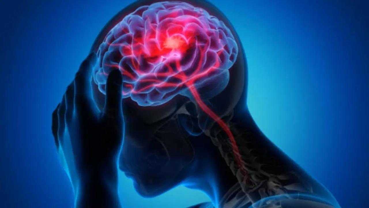 World Stroke Day: Why young adults face a higher risk of stroke from lifestyle choices