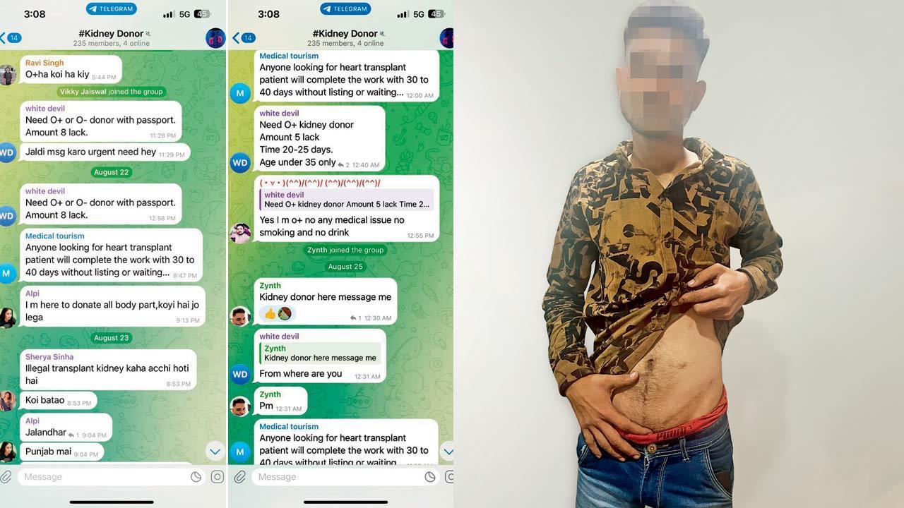 Mid-Day Investigation: Kidney racketeers move online, exploit desperate donors