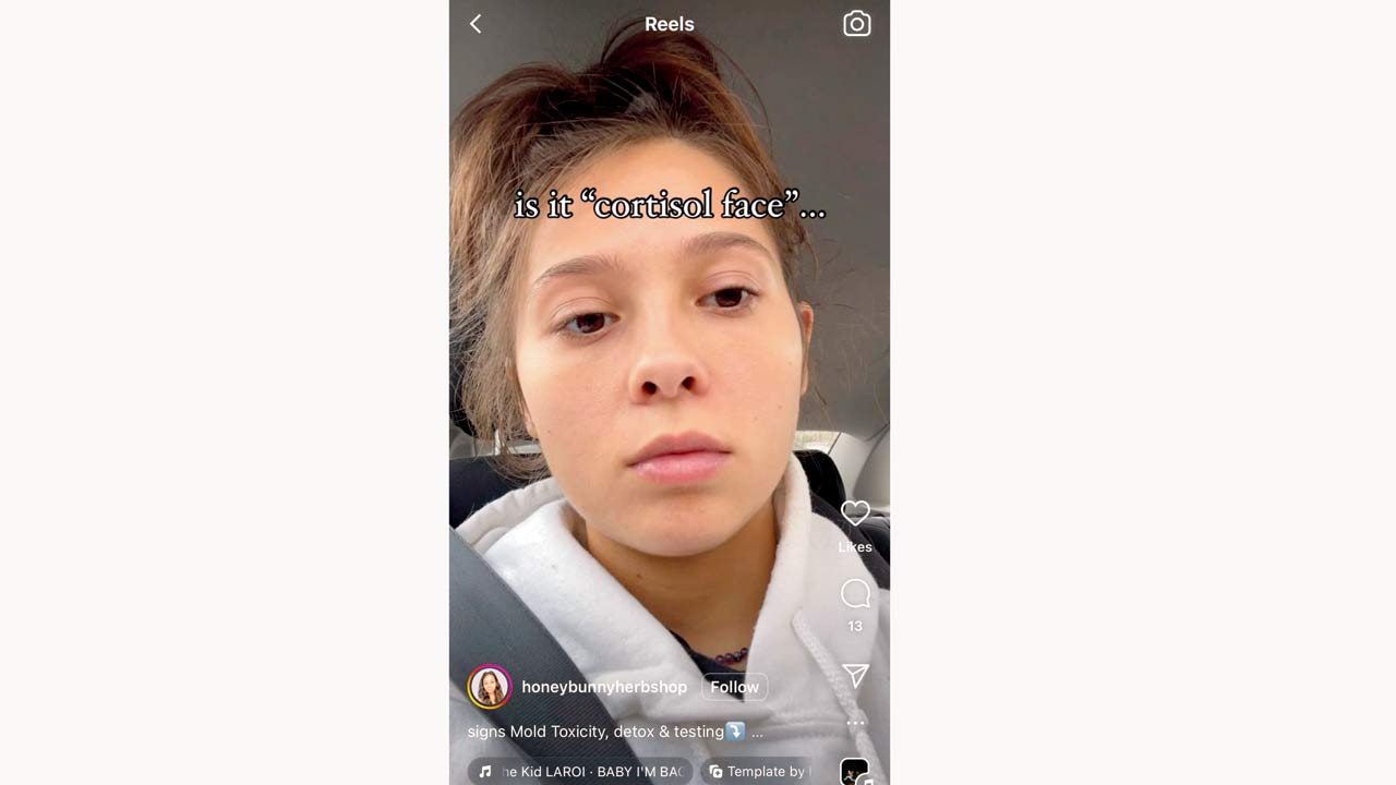 A content creator talks about cortisol face in an Instagram reel. Pic Courtesy/Instagram