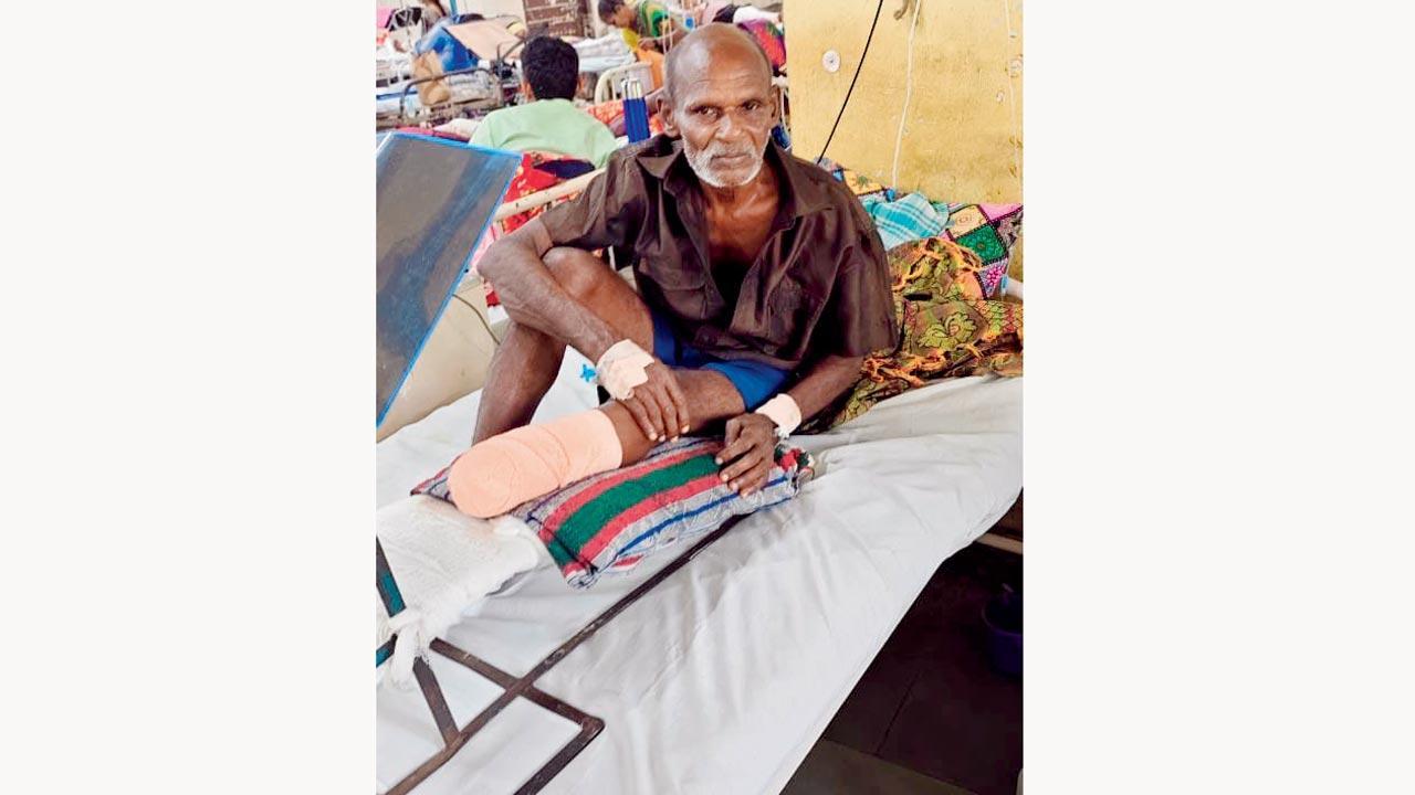 Mumbai: Crocodile attack in city lake costs senior citizen his limb