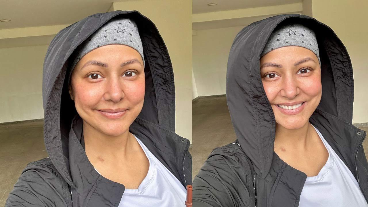 Hina Khan suffering from mucositis: Know all about this side effect of cancer treatment