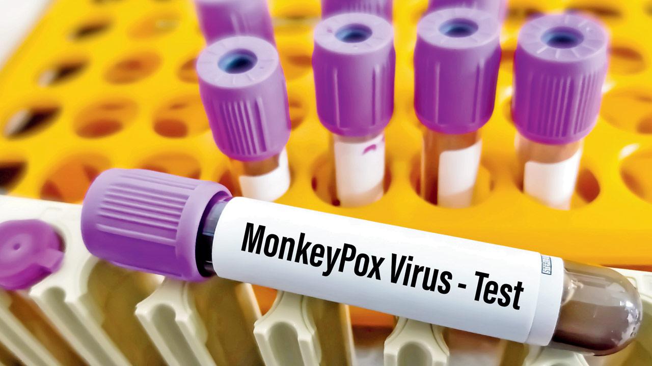 These tests will help ministries of health to initiate their surveillance activities. Representation Pic