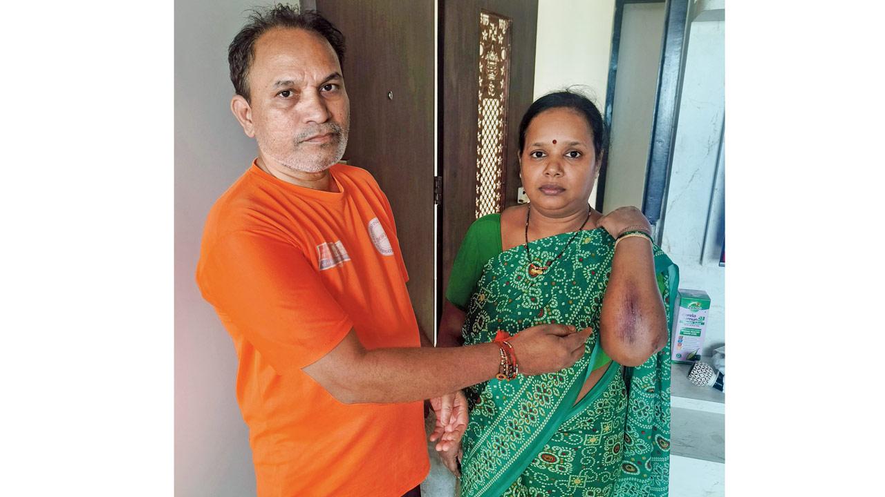 Passer-by Rohini Ambre, on whom a piece of concrete slab fell, shows her injuries at her home
