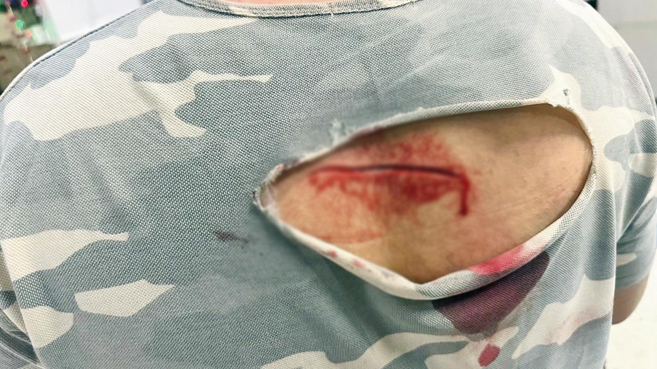 Cut wound on the victim