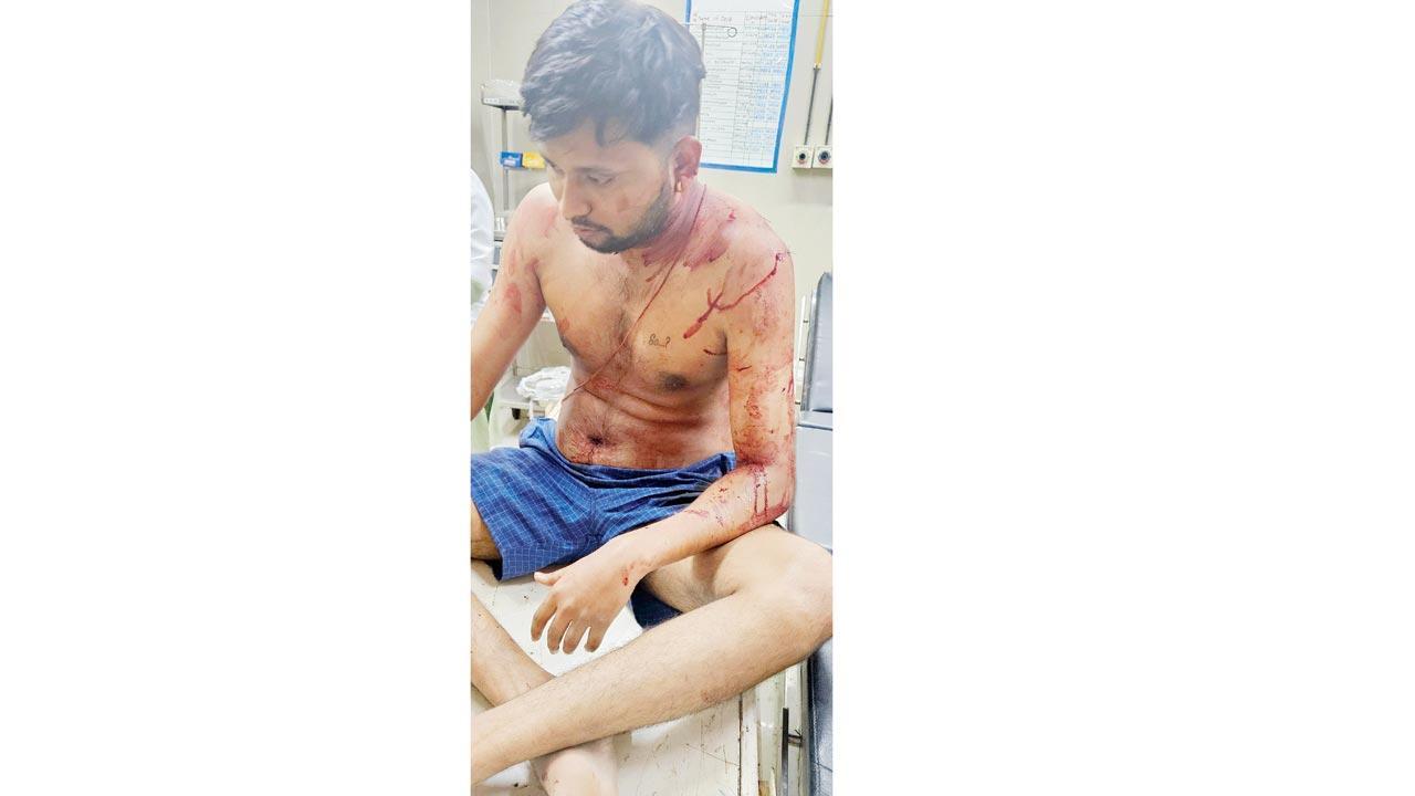 Mumbai: Fight over ‘work efficiency’ lands staffer in ICU