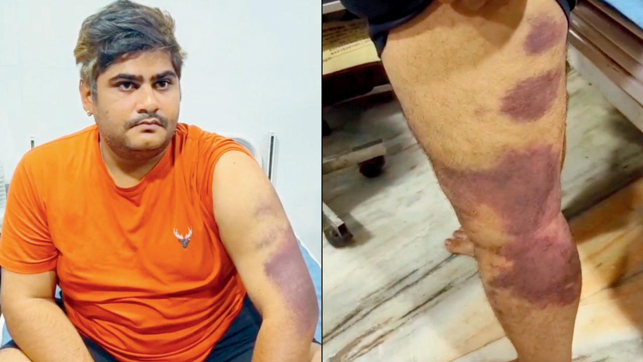 Mumbai: Ulhasnagar priest attacked by friends over alleged affair allegations