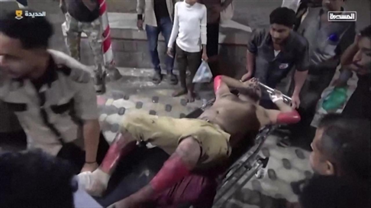 IN PHOTOS: US airstrikes on Yemen oil port kill 38 and injure over 100