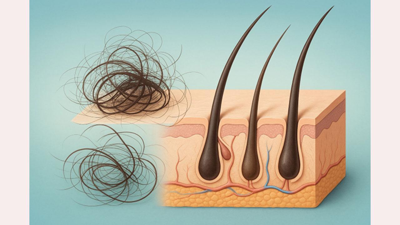 Exploring User Experiences with Traya’s Hair Loss Solution