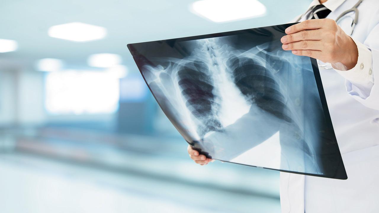 Trying to be disease-free is entirely our responsibility