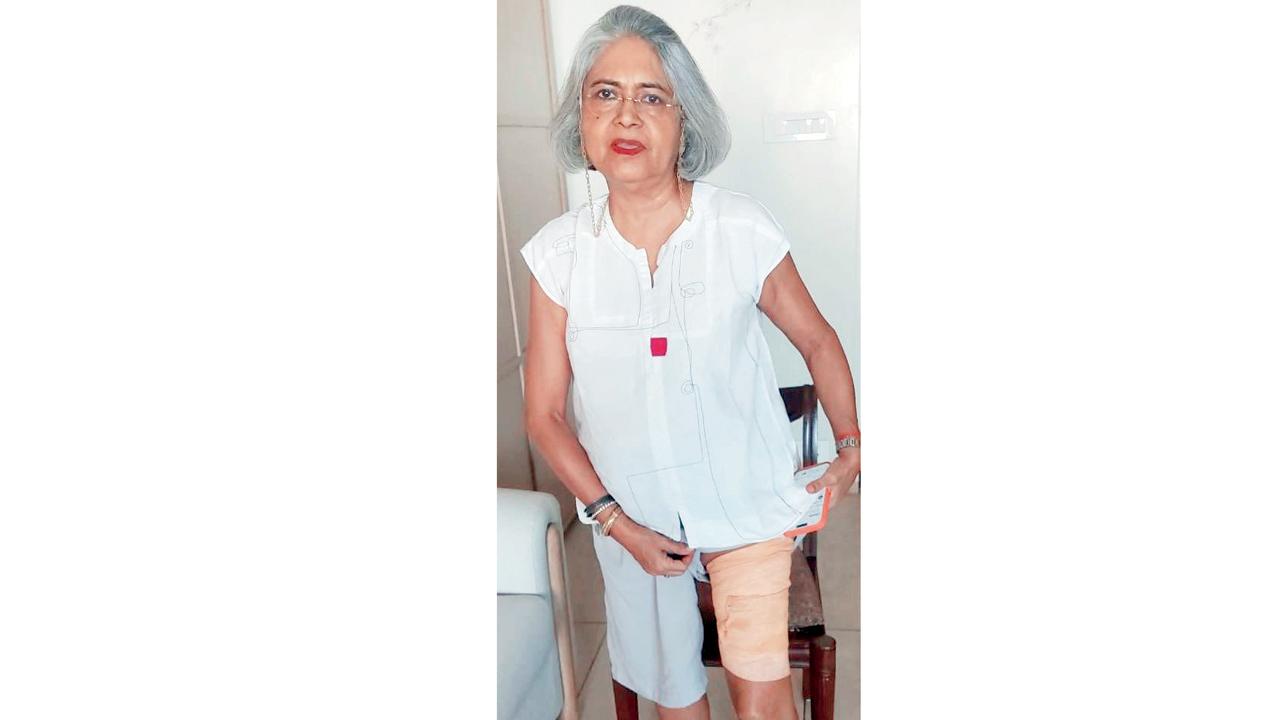 Dina Desai a year ago, with her injured leg
